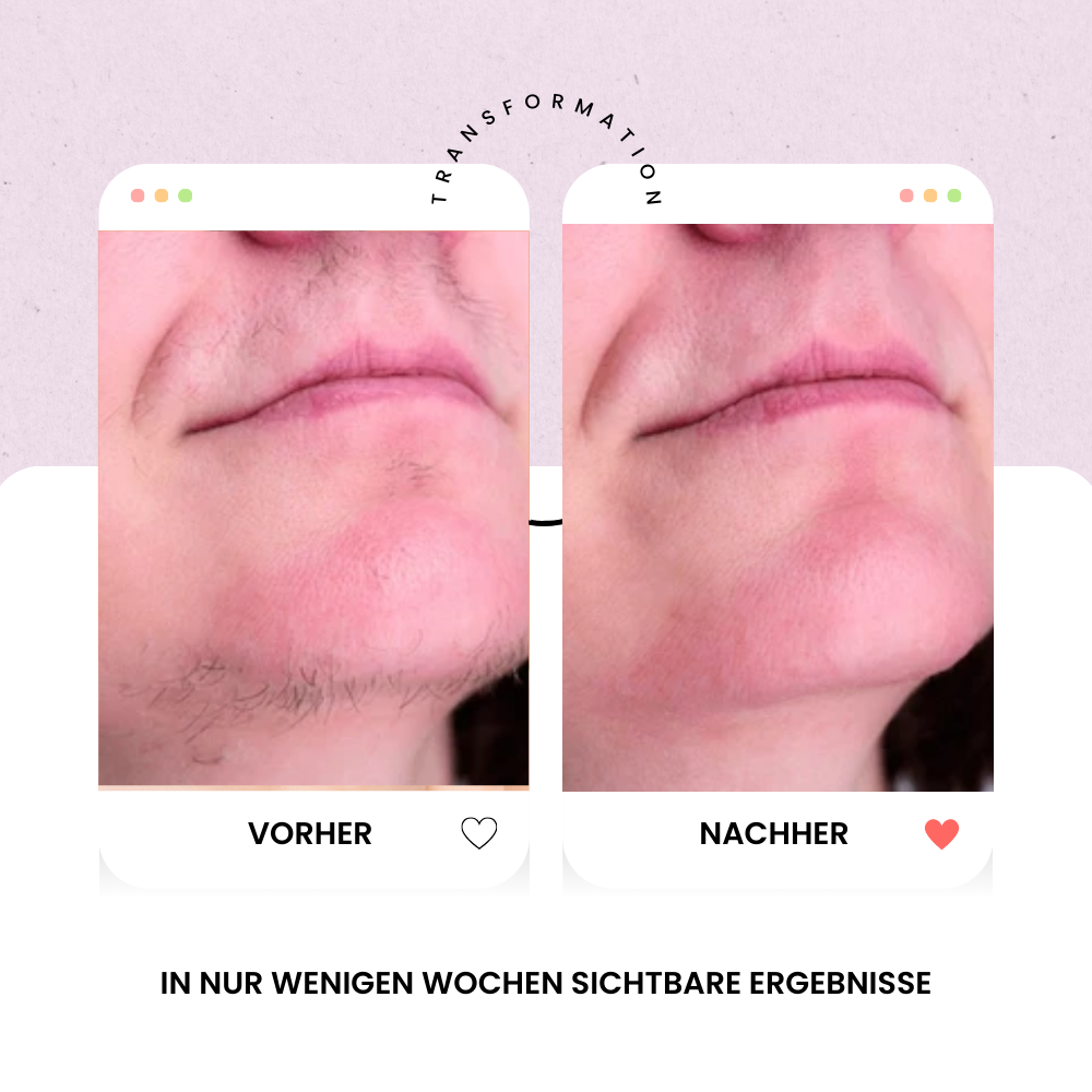 Clariya Paris – Dauerhafte Anti-Haar-Öl